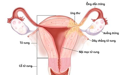 Top benh ung thu co nguy co di truyen rat cao-Hinh-8